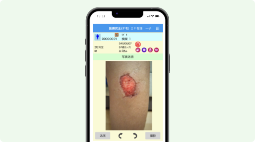 シーエスアイの電子カルテシステム ミライズのモバイルソリューション 写真撮影機能の画面イメージ